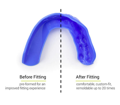Sisu - Tether Mouthguards